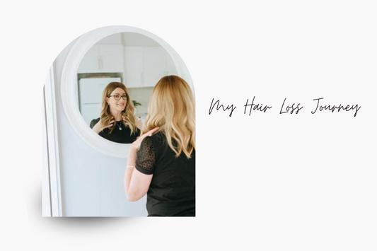 My Hair Loss Journey: Living with Androgenetic Alopecia and Finding Confidence Again